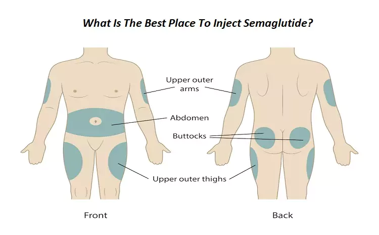 What Is The Best Place To Inject Semaglutide?